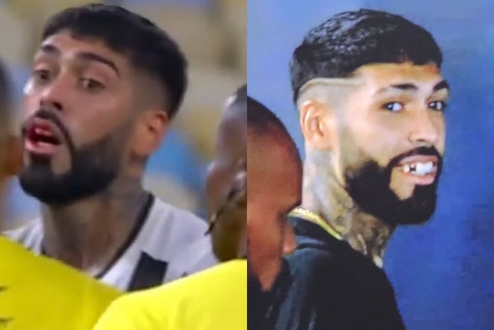 Além da confusão: Flamengo vence e domina Botafogo com dois times diferentes 2 Barboza perde dente após confusão em clássico contra o Flamengo (Foto: Reprodução/Redes Sociais)